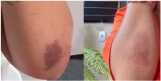 Antes e depois - Lidia Gomes